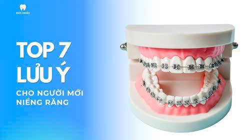 Top 7 điều lưu ý cho người mới niềng răng